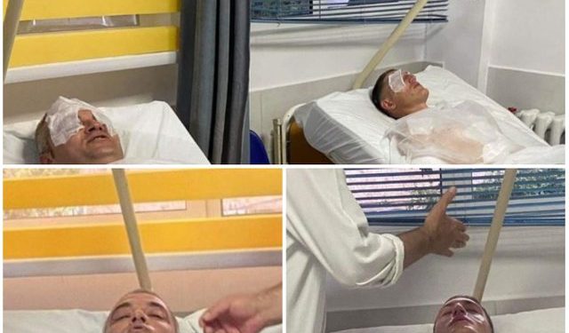 Djegie lëkure, dëmtime në dorë/ Zbardhet akt-ekspertimi për dy ushtarakët e sulmuar në uzinën e Gramshit