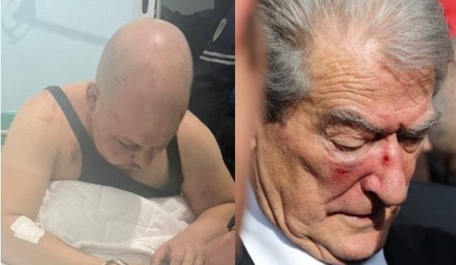 Përfundon ekspertiza për Gerti Shehun, i riu i cili grushtoi Berishën: I papërgjegjshëm mëndërisht